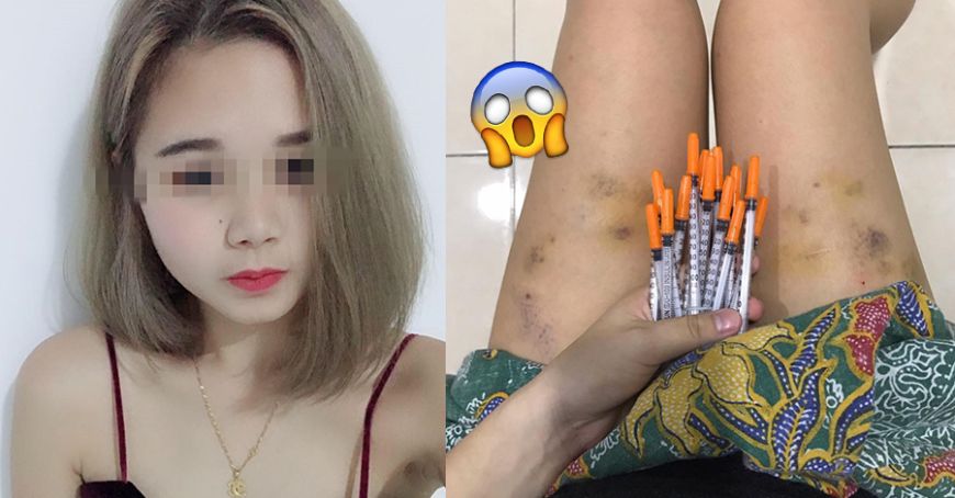 无麻药肚子开刀 西瓜视频搜索